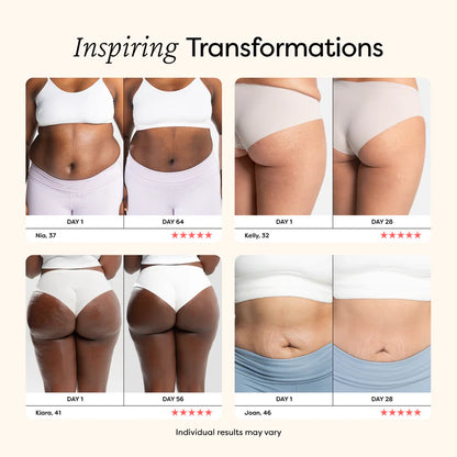 VIBRAFAT™ SLIMMING RING MASSAGER